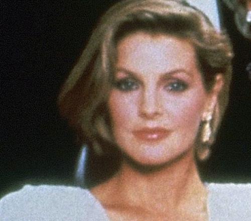 Звезды Голливуда до и после пластических операций