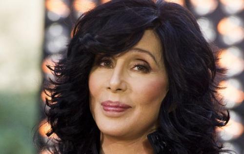 Звезды Голливуда до и после пластических операций