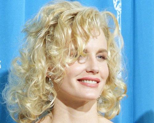 Звезды Голливуда до и после пластических операций