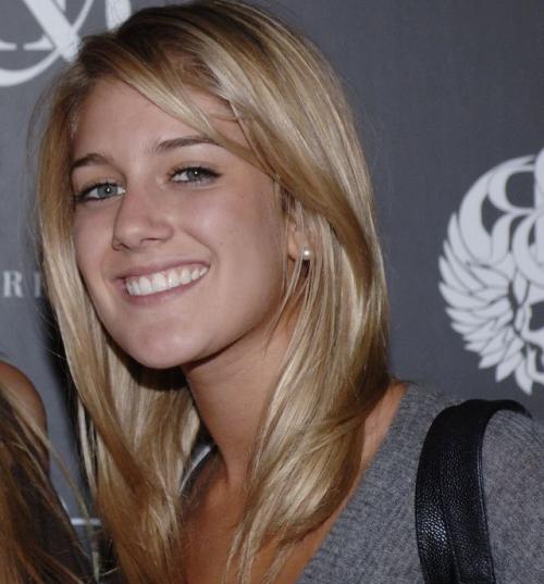 Звезды Голливуда до и после пластических операций