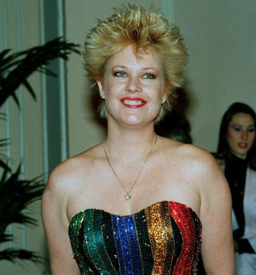 Звезды Голливуда до и после пластических операций