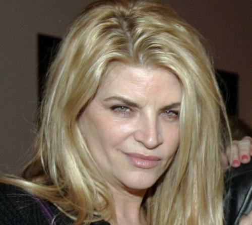 Звезды Голливуда до и после пластических операций