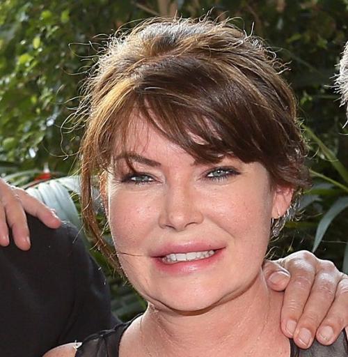 Звезды Голливуда до и после пластических операций