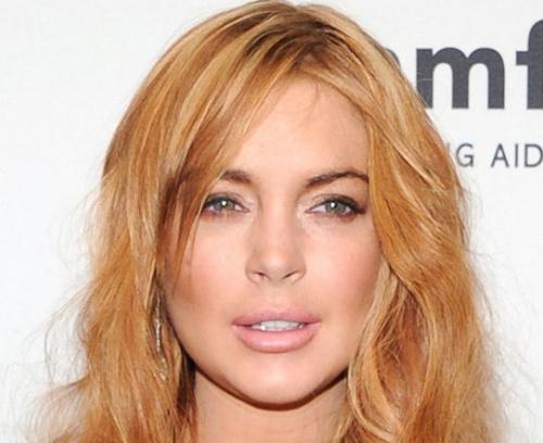 Звезды Голливуда до и после пластических операций