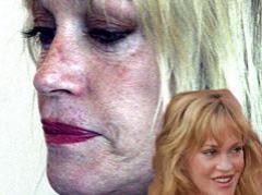 Звезды под скальпелем: до и после пластических операций…