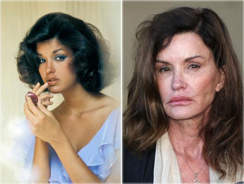 7 звезд, которые с годами изменились до неузнаваемости