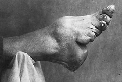 «Лотосовая ножка» или традиции Древнего Китая
