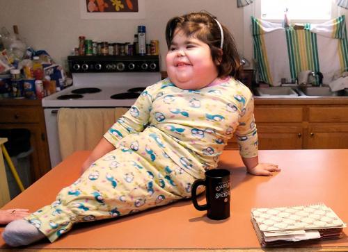 Редкие и удивительные болезни и отклонения