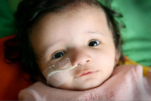 Редкие и удивительные болезни и отклонения