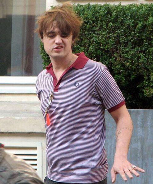 Неудачные фото звезд. Часть 3