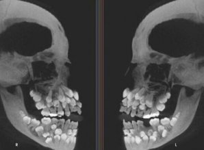 17 рентгеновских снимков, которые врачи не сразу разводят