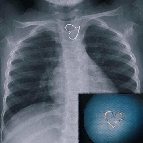 17 рентгеновских снимков, которые врачи не сразу разводят