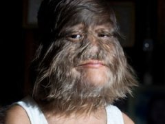 В Таиланде живет девочка-волк