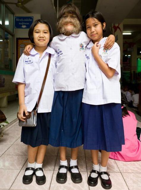 В Таиланде живет девочка-волк