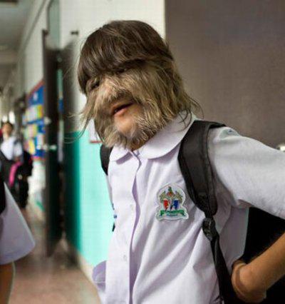 В Таиланде живет девочка-волк