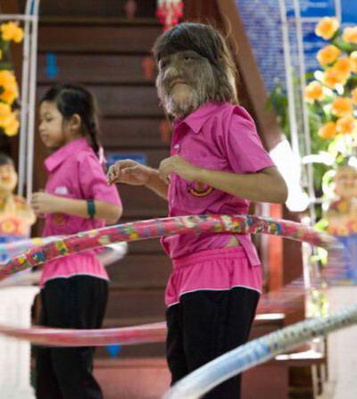 В Таиланде живет девочка-волк