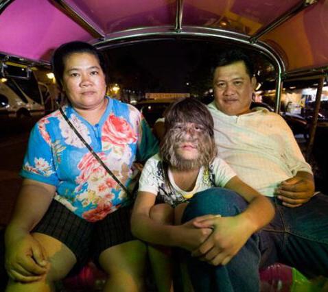 В Таиланде живет девочка-волк