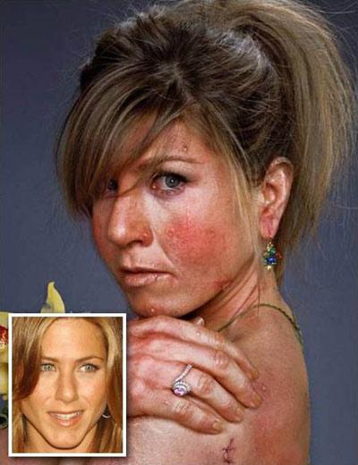 Кошмарные звезды: Photosop против голливудских стандартов красоты