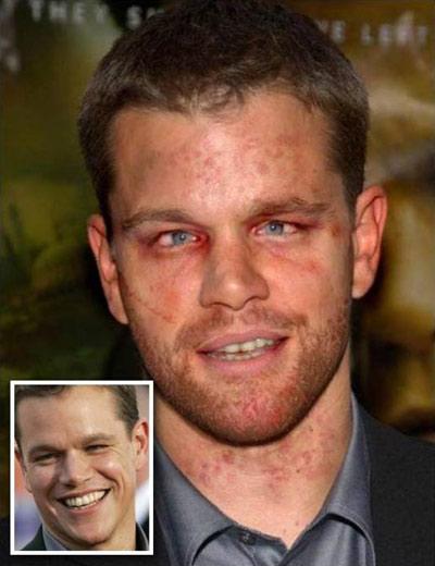 Кошмарные звезды: Photosop против голливудских стандартов красоты