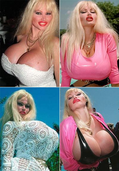 Самые известные жертвы пластической хирургии. Часть 2