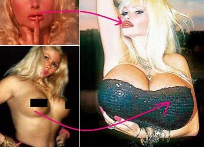 Самые известные жертвы пластической хирургии. Часть 2