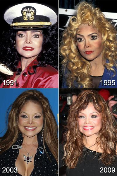 Самые известные жертвы пластической хирургии. Часть 2