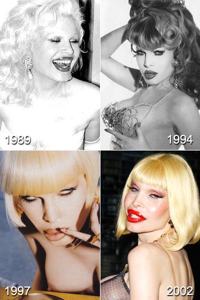 Самые известные жертвы пластической хирургии. Часть 2