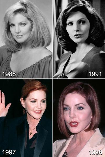 Самые известные жертвы пластической хирургии. Часть 2