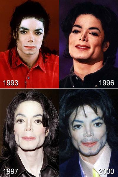 Самые известные жертвы пластической хирургии. Часть 2