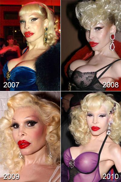 Самые известные жертвы пластической хирургии. Часть 2