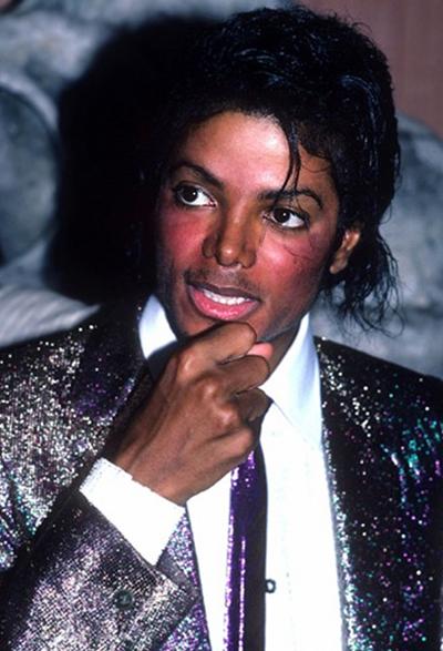 Самые известные жертвы пластической хирургии. Часть 2