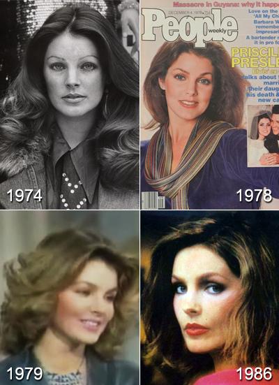 Самые известные жертвы пластической хирургии. Часть 2