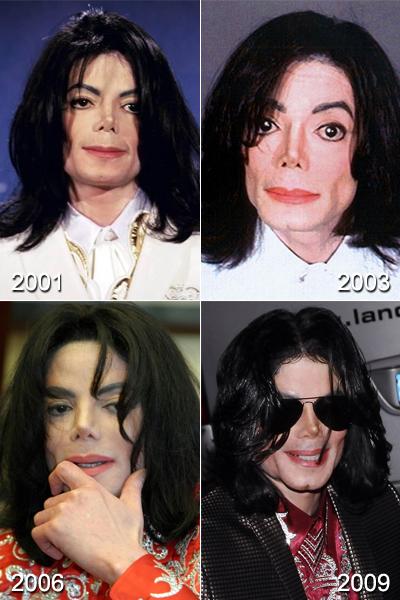 Самые известные жертвы пластической хирургии. Часть 2