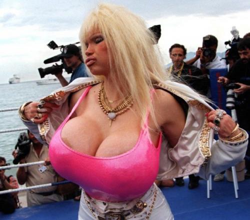 Самые известные жертвы пластической хирургии. Часть 2