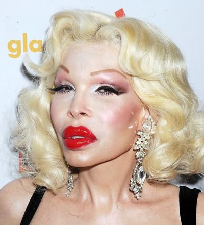 Самые известные жертвы пластической хирургии. Часть 2