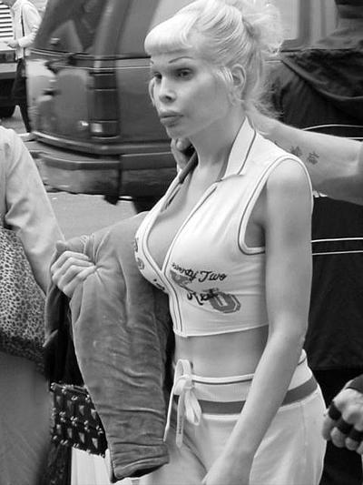 Самые известные жертвы пластической хирургии. Часть 2