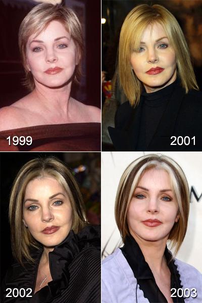 Самые известные жертвы пластической хирургии. Часть 2