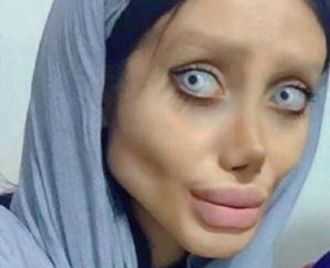 Иранка горела желанием превратиться в Анджелину Джоли