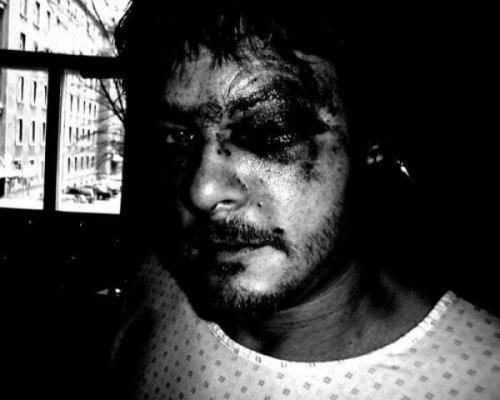 Знаменитости с неизлечимыми заболеваниями, ставшие успешными