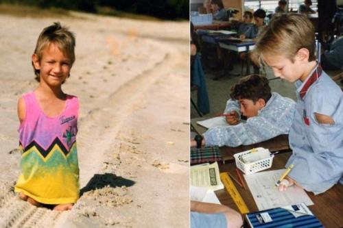 Знаменитости с неизлечимыми заболеваниями, ставшие успешными