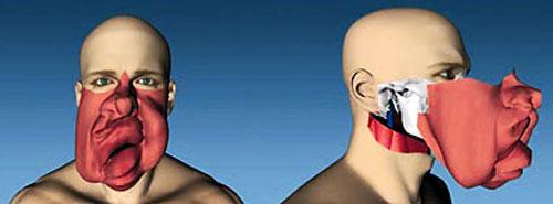 Пересаженные лица прижились