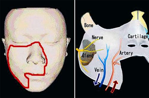Пересаженные лица прижились