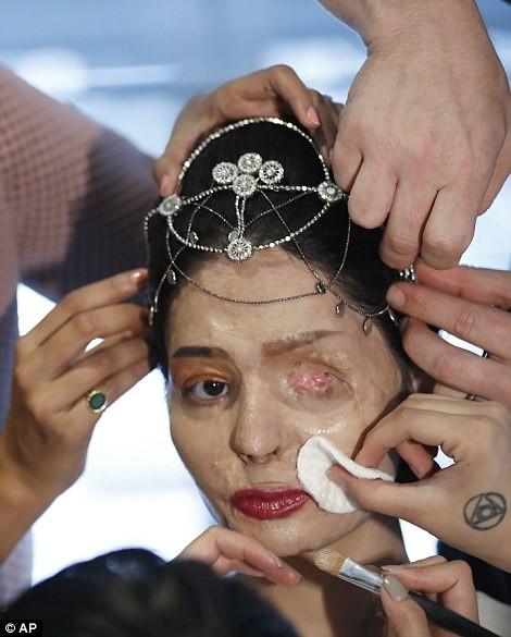 Индийская модель, изуродованная кислотой, вышла на подиум в Нью-Йорке