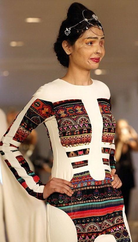 Индийская модель, изуродованная кислотой, вышла на подиум в Нью-Йорке