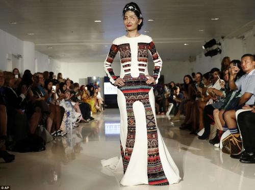 Индийская модель, изуродованная кислотой, вышла на подиум в Нью-Йорке