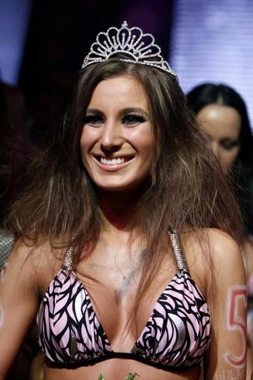 В Венгрии выбрали "Мисс Пластическая хирургия – 2010"