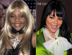 Рекордсмены пластической хирургии