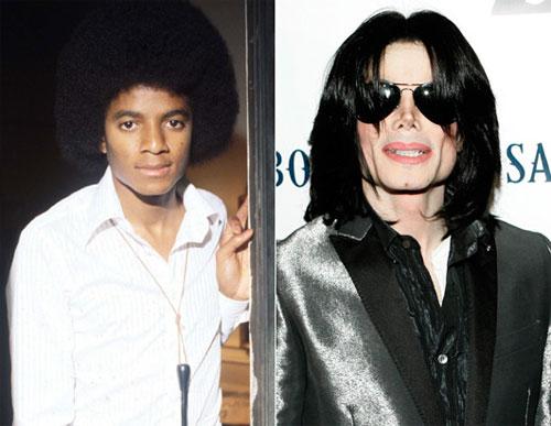 Майкл  Джексон изменился до неузнаваемости – отбеливание кожи, ринопластика, хирургическим путём созданный «мужественный» подбородок – это лишь небольшой список коррекций… Но Джексон не даёт комментариев по этому поводу… Лишь один раз в интервью Опре Уинфри в 1993 году он заявил, что обесцвечивание  его кожи – это результат редкого  кожного заболевания под названием «витилиго»… 