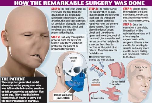 Человек с полной трансплантацией лица появился на публике