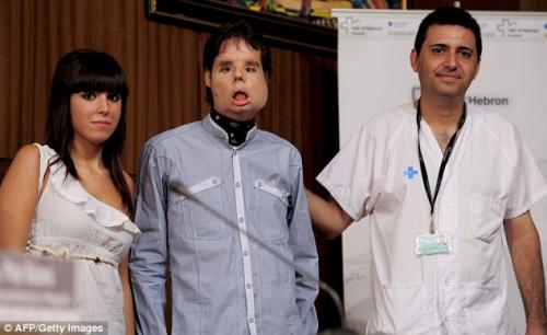 Человек с полной трансплантацией лица появился на публике